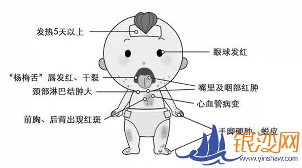 5����ͯ���������鲡 �׶����ղ���Ī����